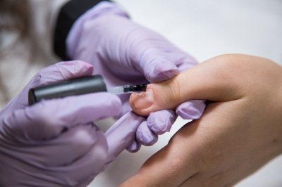 Врач Кузнецов: агрессивное снятие лака способствует занесению грибков в ноготь