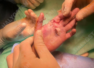 Переломы получил ребенок в игровом центре Астаны