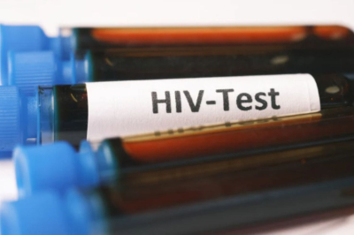 Каждый шестой житель Атырауской области прошёл тест на ВИЧ: озвучена статистика